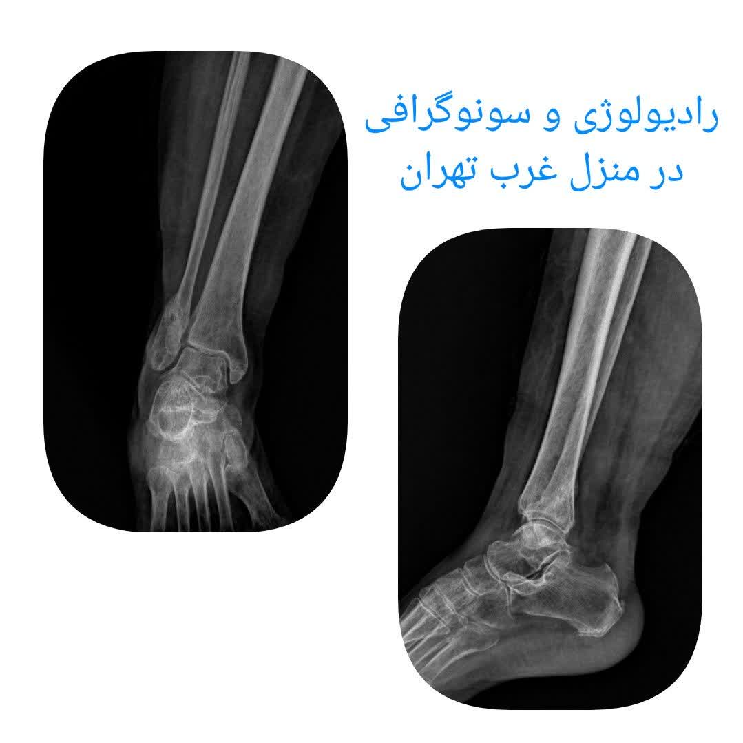 رادیولوژی در منزل غرب تهران