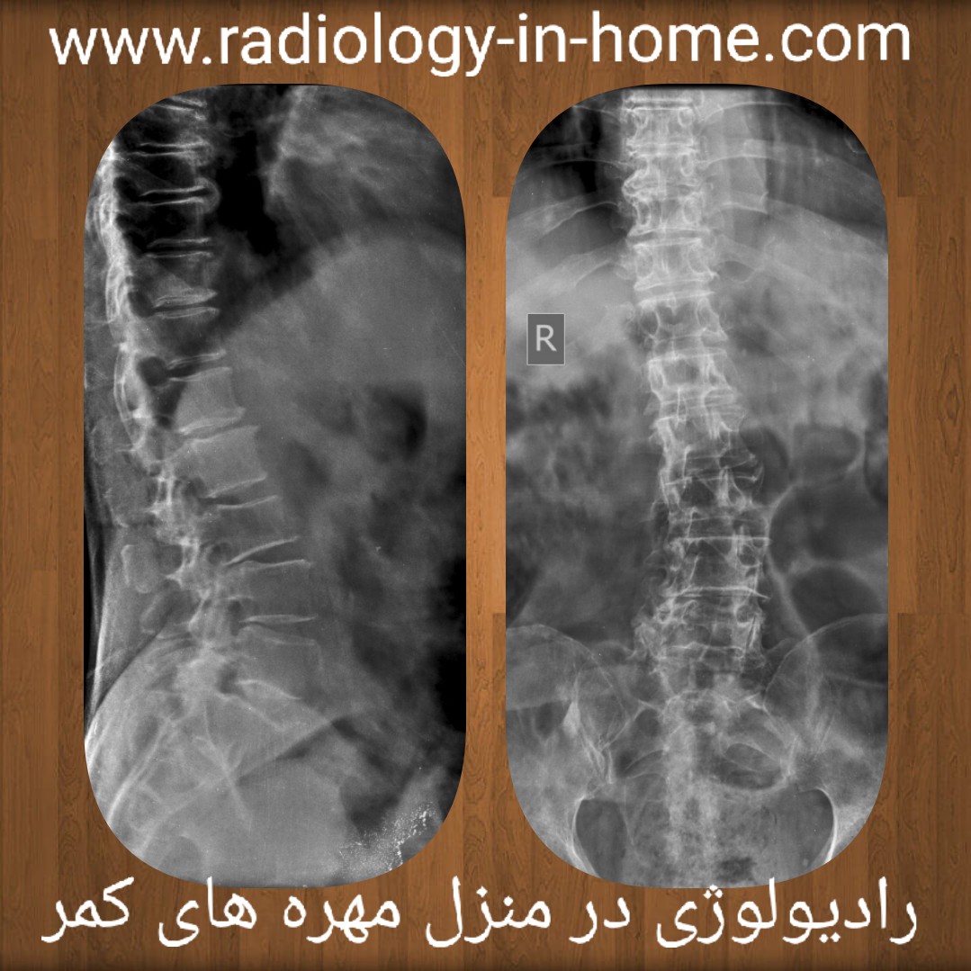 رادیولوژی در منزل در شهر شیراز