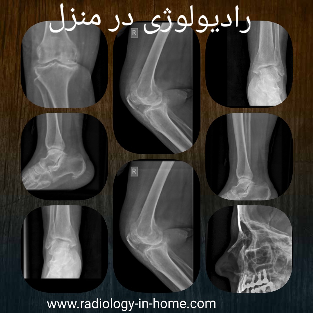 الو رادیولوژی سونوگرافی در منزل تهران کرج مشهد اصفهان شیراز قم قزوین