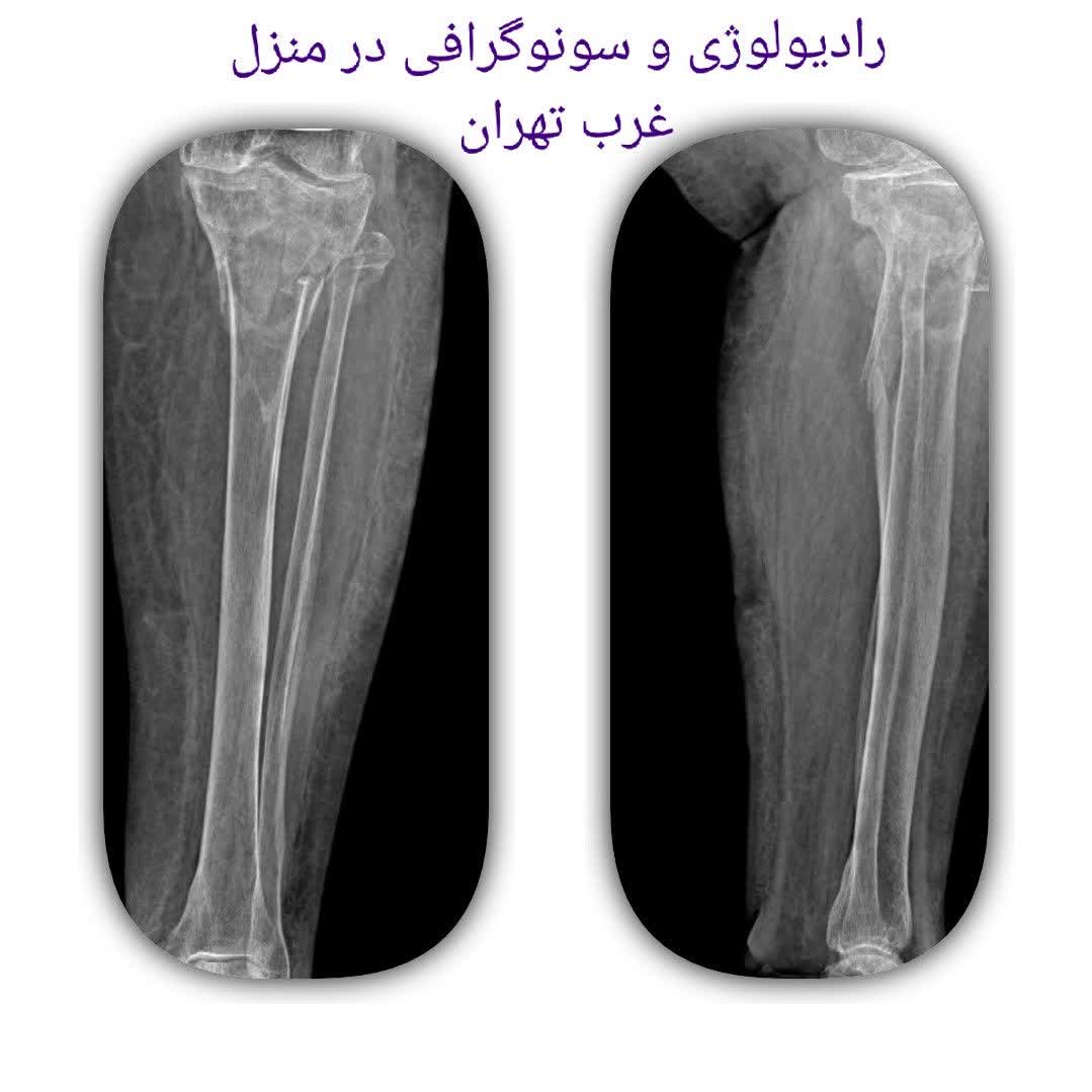 سونوگرافی در منزل غرب تهران