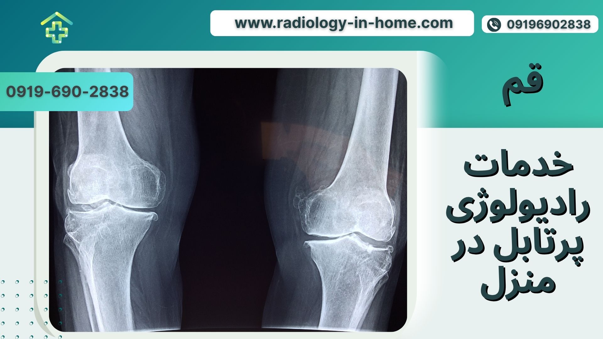 اعزام کارشناس رادیولوژی به منزل قم