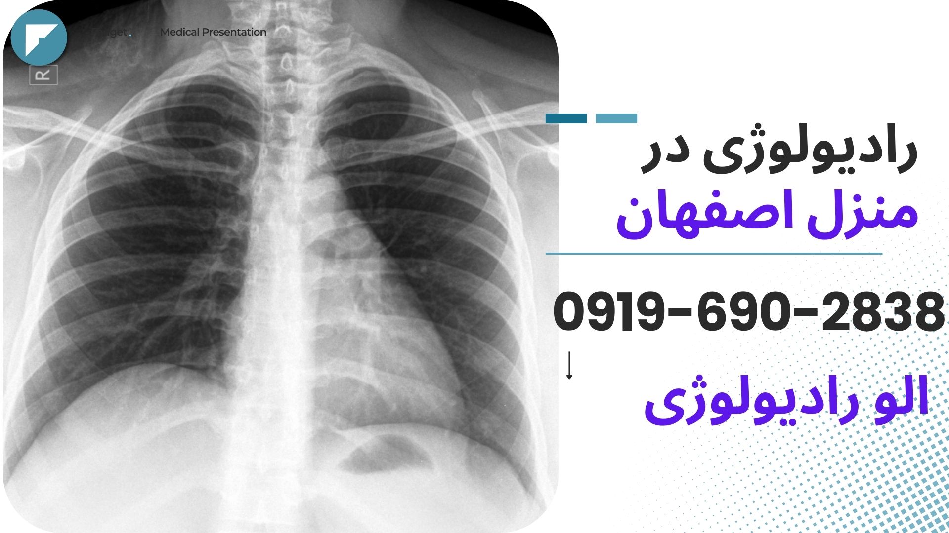 رادیولوژی شانه در منزل اصفهان رادیولوژی دست و بازو در منزل اصفهان رادیولوژی شکم و ریه در منزل اصفهان رادیولوژی ستون فقرات در منزل اصفهان رادیولوژی فوری در منزل اصفهان تصویربرداری پزشکی در خانه اصفهان ارسال کارشناس رادیولوژی به منزل اصفهان رادیولوژی خانگی برای سالمندان اصفهان رادیولوژی خانگی بدون جابهجایی بیمار اصفهان