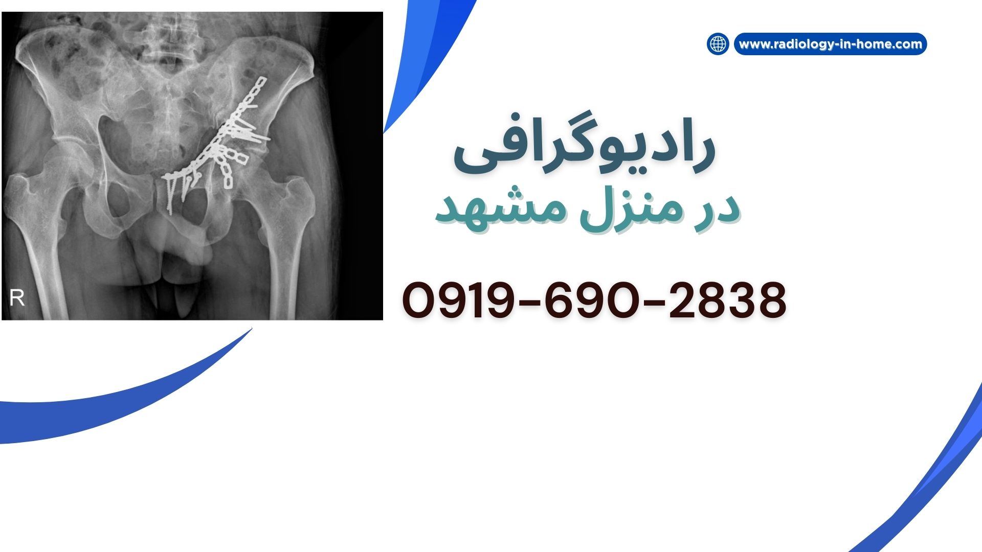 رادیولوژی لگن در منزل مشهد رادیولوژی در خانه در مشهد