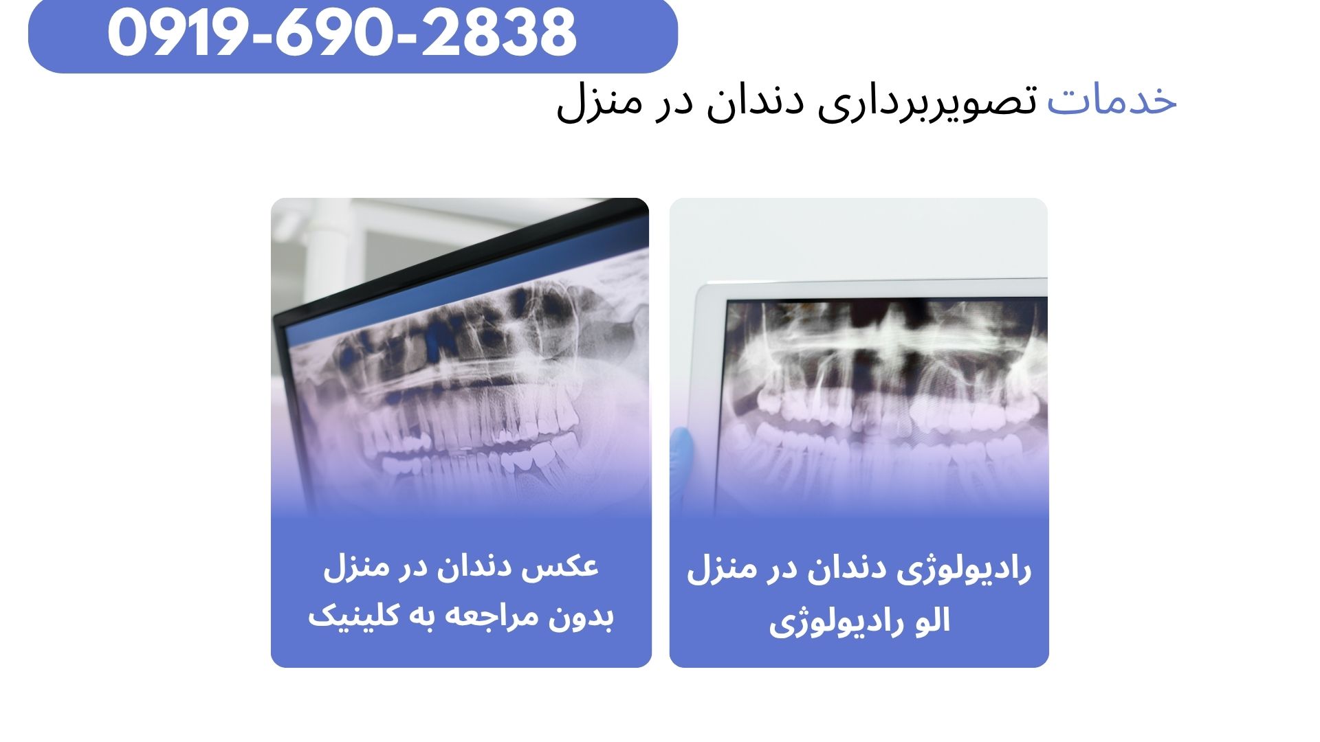 عکس تک دندان در منزل تهران و کرج عکس تک دندان در منزل تهران و کرج، رادیولوژی دیجیتال دندان، عکس پری اپیکال، رادیولوژی دندان در منزل