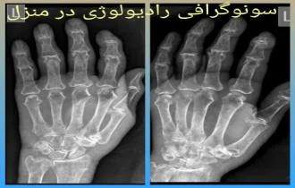 رادیولوژی انگشتان دست و پا در منزل