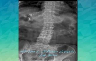 رادیولوژی  در منزل تهران