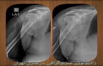 نسل جدید خدمات پزشکی: رادیولوژی در منزل