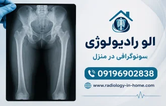 رادیولوژی ران یا فمور در منزل 
