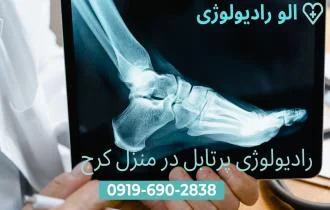 رادیولوژی در منزل کرج و البرز 