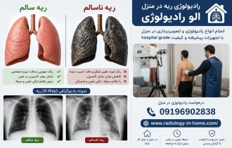 رادیولوژی در منزل از ریه و قفسه سینه، عکس ریه سالم و ناسالم