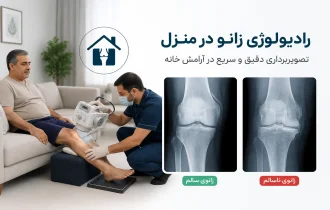 رادیولوژی زانو در منزل تهران و کرج