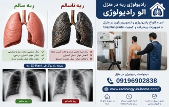 رادیولوژی در منزل از ریه و قفسه سینه، عکس ریه سالم و ناسالم