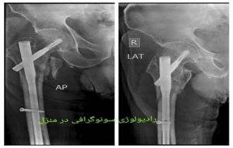 مزایای و معایب رادیولوژی در منزل  تهران و کرج