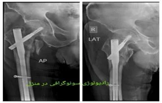 مزایای و معایب رادیولوژی در منزل